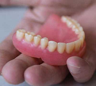 Acrylic Dentures